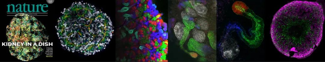 研究人员对人体的微型肾脏进行生物3D打印(图1) 研究人员对人体的微型肾脏进行生物3D打印(图1)