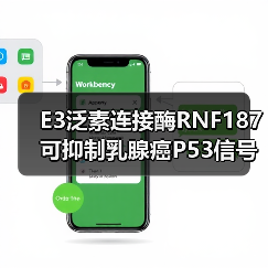 E3泛素连接酶RNF187可抑制乳腺癌P53信号传导、促进癌症生长(图4)