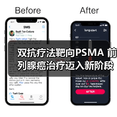 双抗疗法靶向PSMA 前列腺癌治疗迈入新阶段(图2) 双抗疗法靶向PSMA 前列腺癌治疗迈入新阶段(图2)