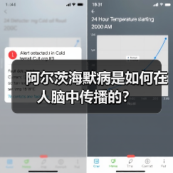 阿尔茨海默病是如何在人脑中传播的?(图3) 阿尔茨海默病是如何在人脑中传播的?(图3)